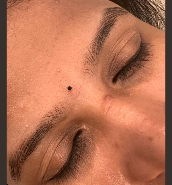 Eyebrow Microblading